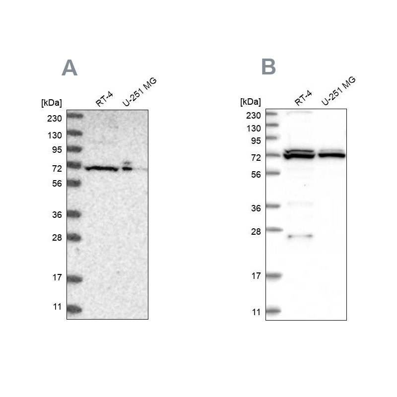 Western blot analysis using Anti-DARS2 antibody HPA026506 (A) shows similar pattern to independent antibody HPA026528 (B).