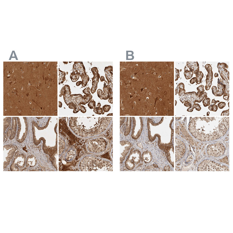 Immunohistochemical staining of human cerebral cortex, placenta, prostate and testis using Anti-CAMSAP2 antibody HPA026511 (A) shows similar protein distribution across tissues to independent antibody HPA026304 (B).