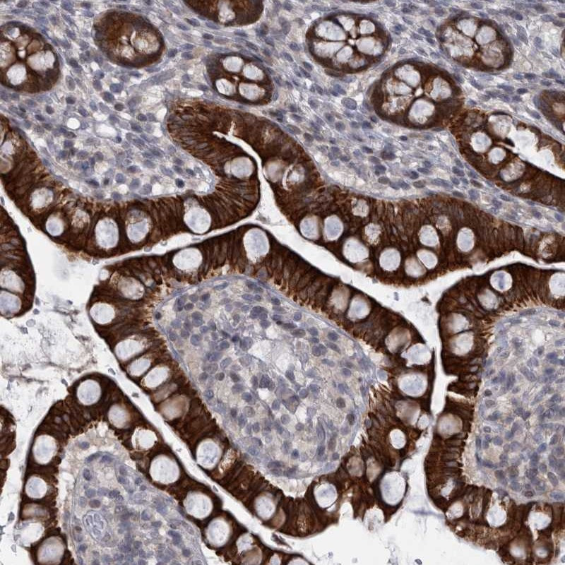 Immunohistochemical staining of human small intestine shows strong cytoplasmic positivity in glandular cells.