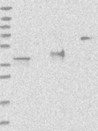 Lane 1: Marker [kDa] 230, 130, 95, 72, 56, 36, 28, 17, 11 | Lane 2: RT4 | Lane 3: U-251 MG | Lane 4: Human Plasma | Lane 5: Liver | Lane 6: Tonsil
