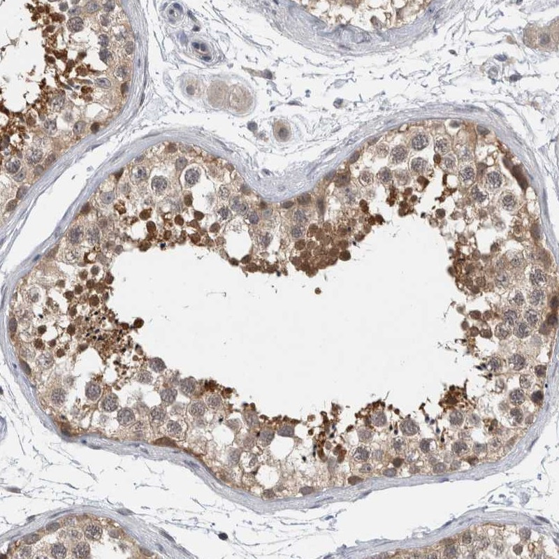 Immunohistochemical staining of human testis shows strong cytoplasmic positivity in spermatids.