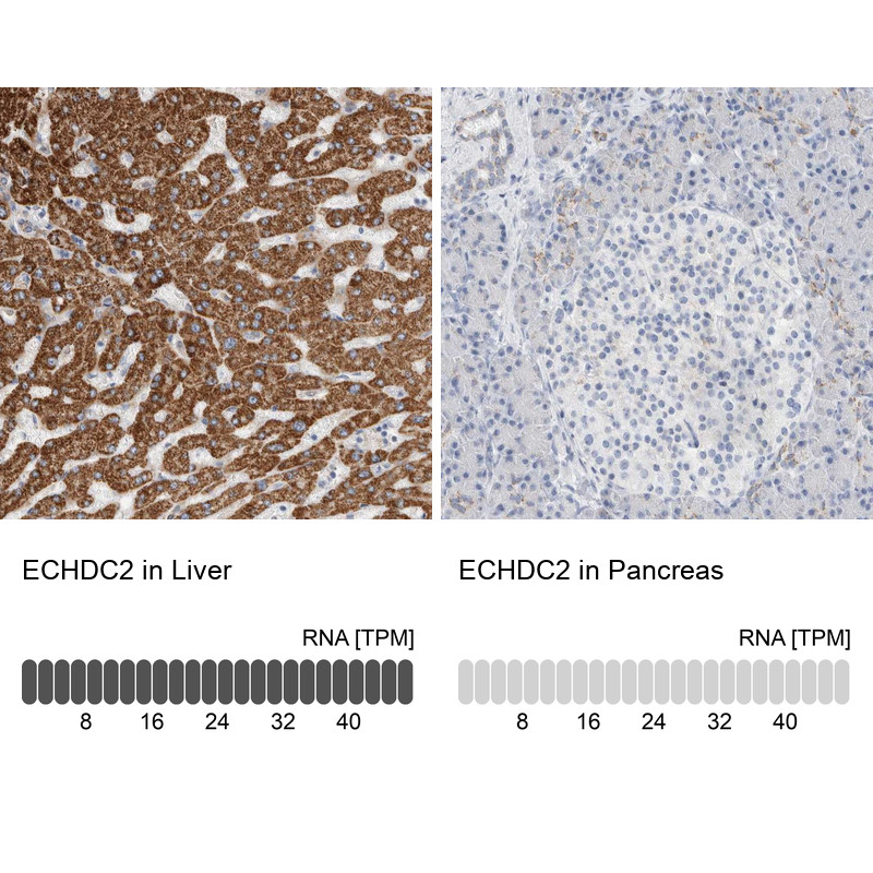 Immunohistochemistry analysis in human liver and pancreas tissues using Anti-ECHDC2 antibody. Corresponding ECHDC2 RNA-seq data are presented for the same tissues.
