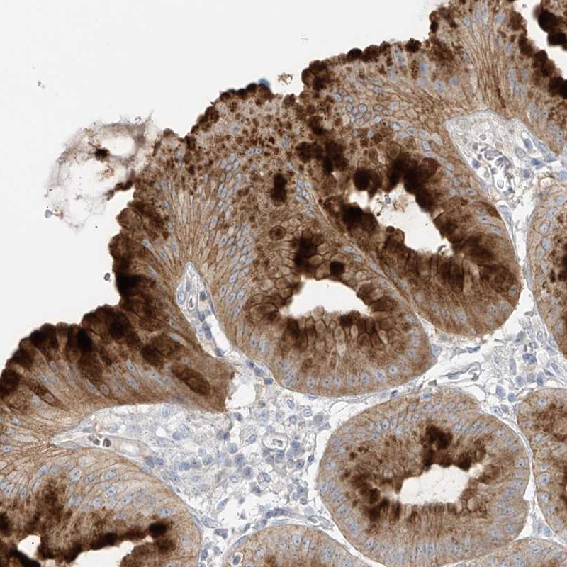 Immunohistochemical staining of human stomach shows strong cytoplasmic positivity in superficial glandular cells.