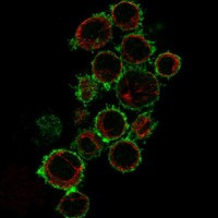Immunofluorescent staining of human cell line HDLM-2 shows localization to plasma membrane & centriolar satellites.