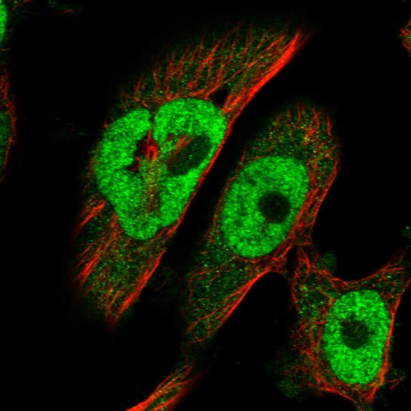 Immunofluorescent staining of human cell line U-251 MG shows localization to nucleoplasm & cytosol.
