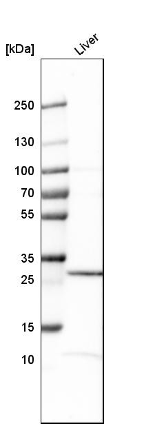 Western blot analysis in human liver tissue.