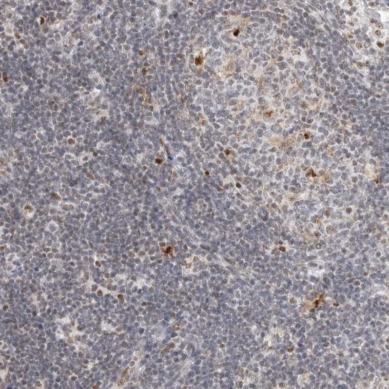 Immunohistochemical staining of human lymphe node shows strong nuclear positivity in germinal center cells.