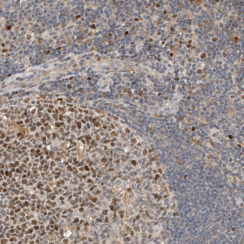 Immunohistochemical staining of human tonsil shows nuclear and cytoplasmic positivity in both germinal center and non-germinal center cells.