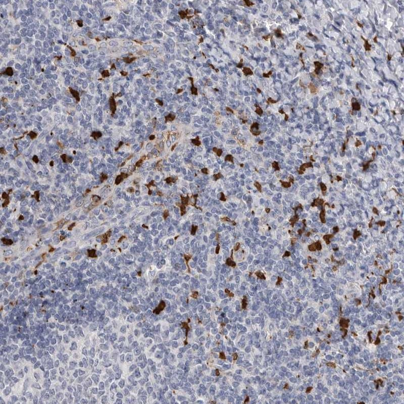 Immunohistochemical staining of human tonsil shows strong cytoplasmic positivity in subsets of lymphoid cells.