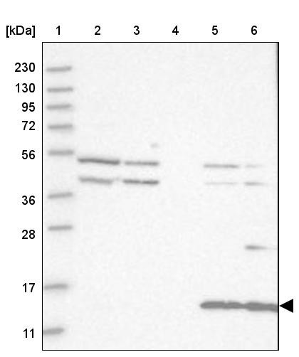 Lane 1: Marker [kDa] 230, 130, 95, 72, 56, 36, 28, 17, 11<br/>Lane 2: Human cell line RT-4<br/>Lane 3: Human cell line U-251MG sp<br/>Lane 4: Human plasma (IgG/HSA depleted)<br/>Lane 5: Human liver tissue<br/>Lane 6: Human tonsil tissue