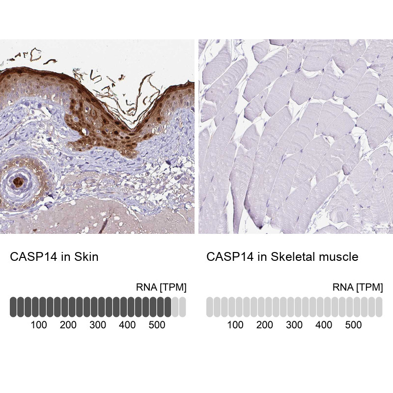 Immunohistochemistry analysis in human skin and skeletal muscle tissues using HPA027062 antibody. Corresponding CASP14 RNA-seq data are presented for the same tissues.
