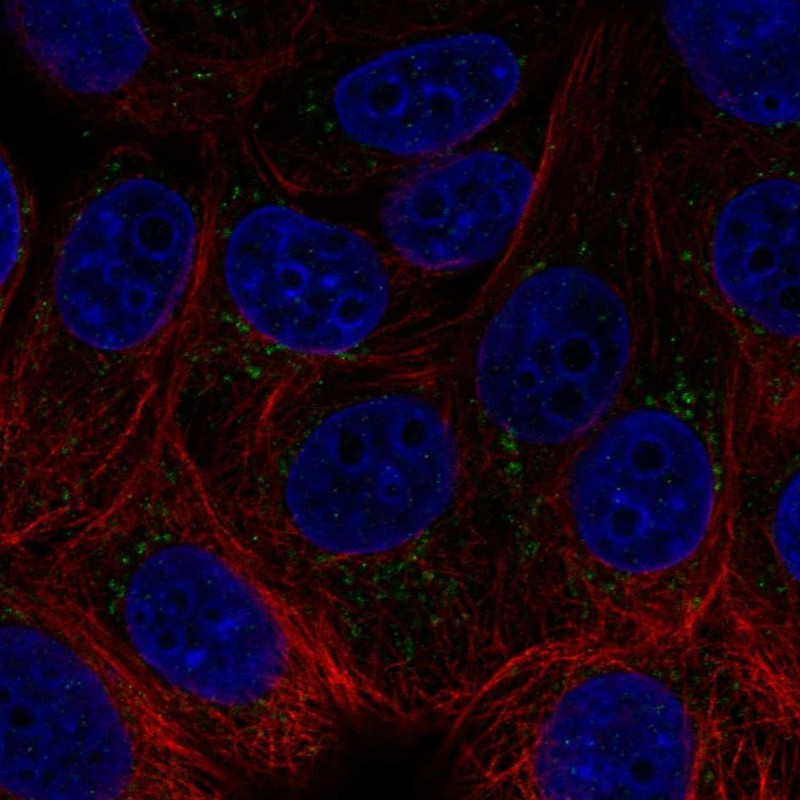 Immunofluorescent staining of human cell line MCF7 shows localization to the Golgi apparatus.