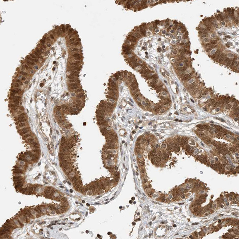Immunohistochemical staining of human Fallopian tube shows strong cytoplasmic and nuclear positivity in glandular cells.