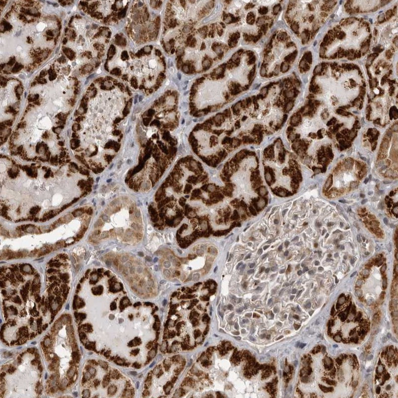 Immunohistochemical staining of human kidney shows strong cytoplasmic positivity in cells of renal tubles.