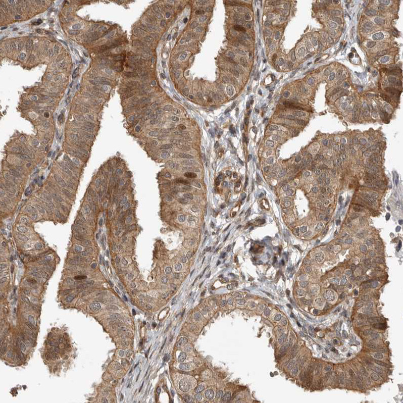 Immunohistochemical staining of human Fallopian tube shows moderate cytoplasmic positivity in glandular cells.