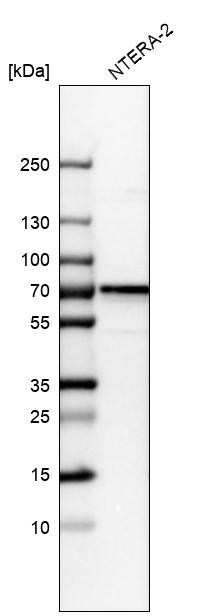 Western blot analysis in human cell line NTERA-2.