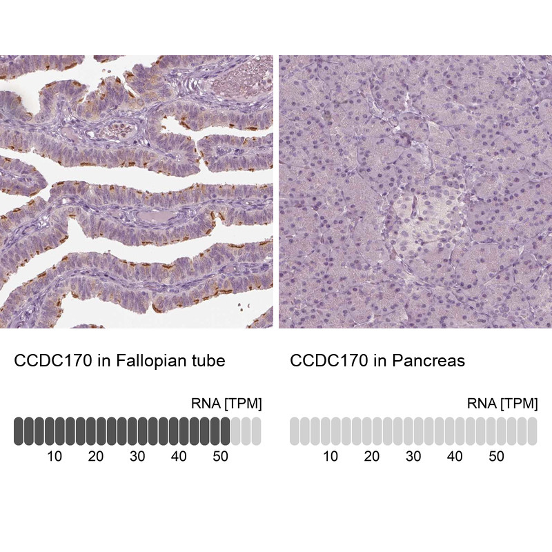 Immunohistochemistry analysis in human fallopian tube and pancreas tissues using Anti-CCDC170 antibody. Corresponding CCDC170 RNA-seq data are presented for the same tissues.