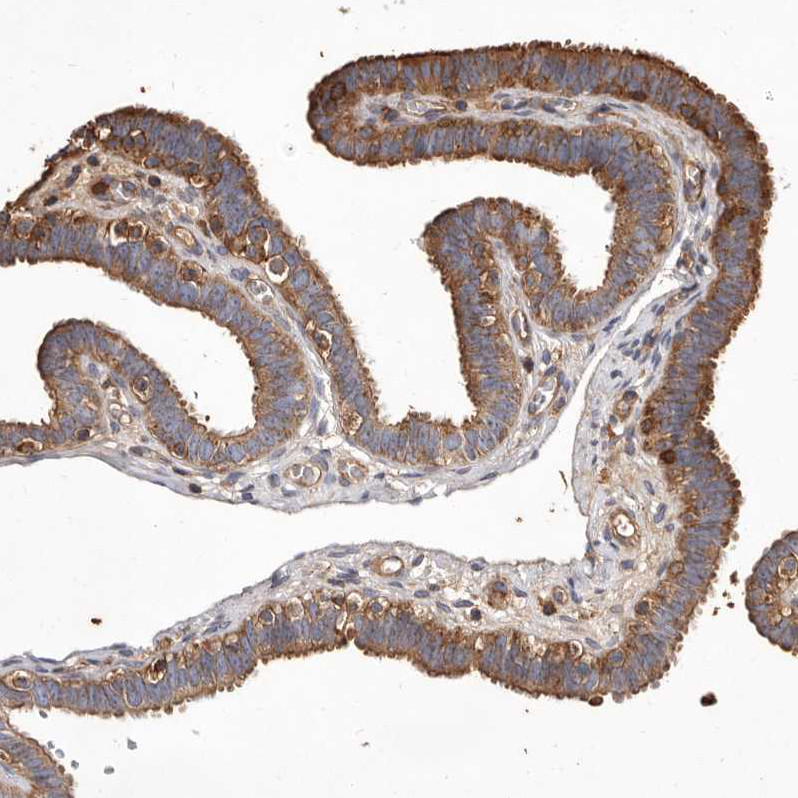 Immunohistochemical staining of human fallopian tube shows moderate membranous and cytoplasmic positivity in glandular cells.