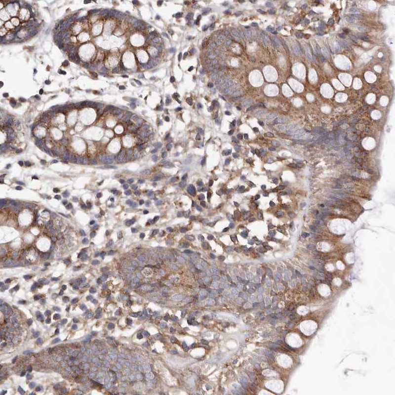 Immunohistochemical staining of human colon shows moderate cytoplasmic positivity in glandular cells.