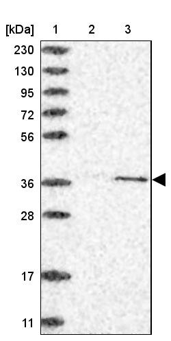 Lane 1: Marker [kDa] 230, 130, 95, 72, 56, 36, 28, 17, 11<br/>Lane 2: Human cell line RT-4<br/>Lane 3: Human cell line U-251MG sp