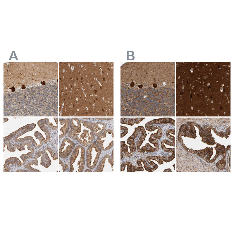 Immunohistochemical staining of human cerebellum, cerebral cortex, fallopian tube and prostate using Anti-BAIAP2 antibody HPA027421 (A) shows similar protein distribution across tissues to independent antibody HPA023310 (B).