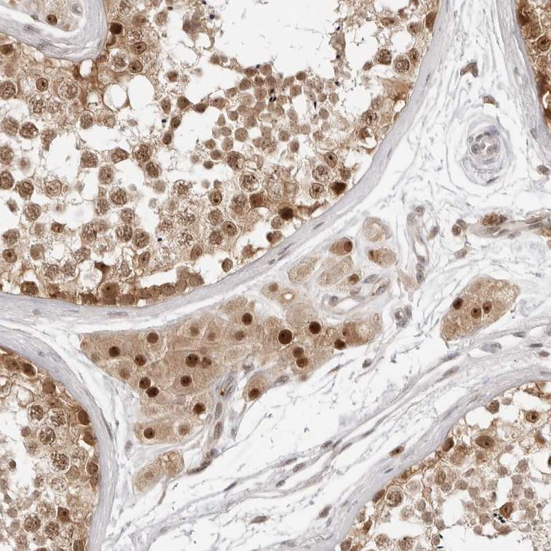 Immunohistochemical staining of human testis shows moderate nuclear and cytoplasmic positivity in cells in seminiferous ducts, Leydig cells were strongly stained.