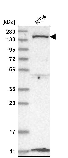 Western blot analysis in human cell line RT-4.