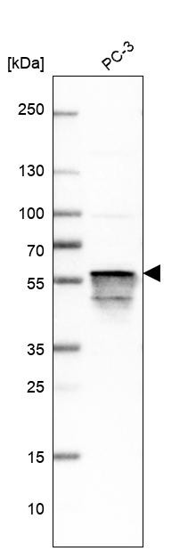 Western blot analysis in human cell line PC-3.