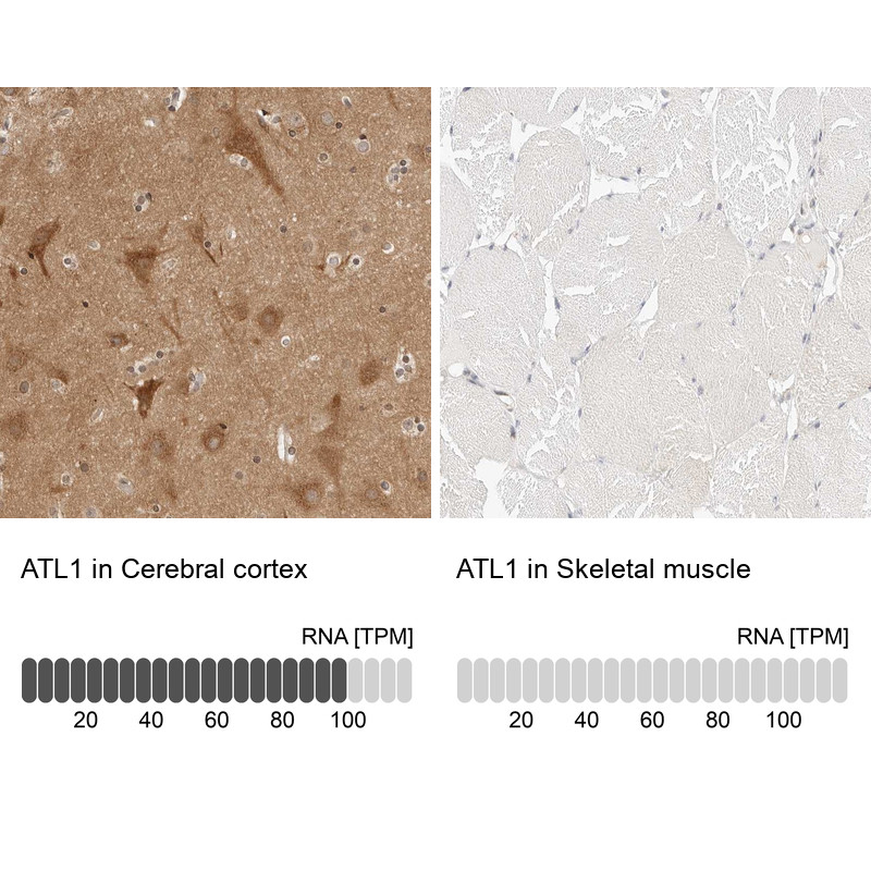 Immunohistochemistry analysis in human cerebral cortex and skeletal muscle tissues using Anti-ATL1 antibody. Corresponding ATL1 RNA-seq data are presented for the same tissues.