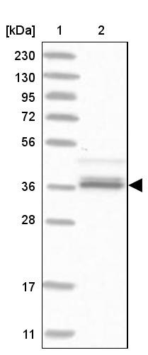 Lane 1: Marker [kDa] 230, 130, 95, 72, 56, 36, 28, 17, 11<br/>Lane 2: Human cell line RT-4