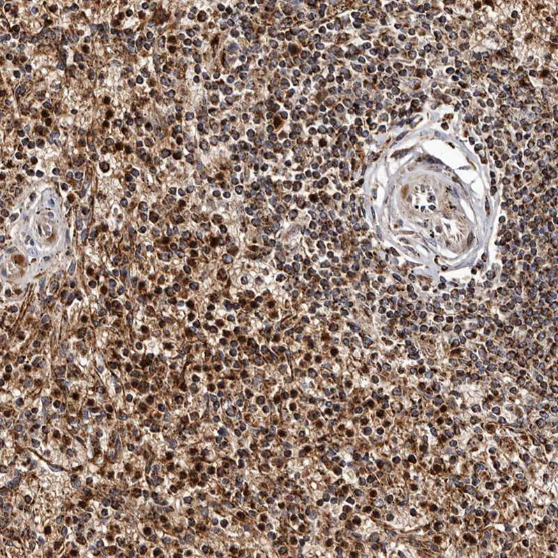 Immunohistochemical staining of human spleen shows moderate to strong cytoplasmic positivity.