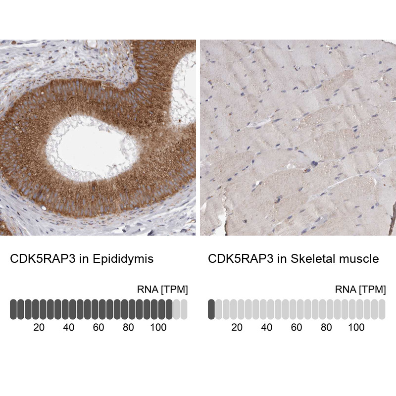Immunohistochemistry analysis in human epididymis and skeletal muscle tissues using HPA027883 antibody. Corresponding CDK5RAP3 RNA-seq data are presented for the same tissues.