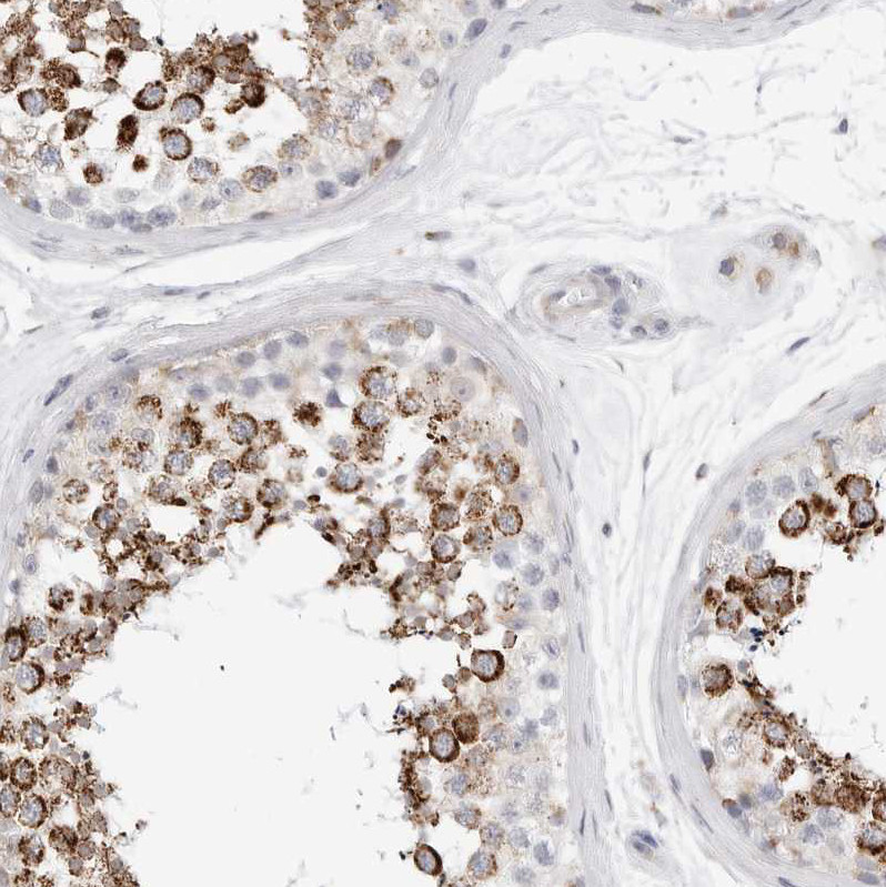 Immunohistochemical staining of human testis shows strong cytoplasmic granular positivity in cells in seminiferous ducts.