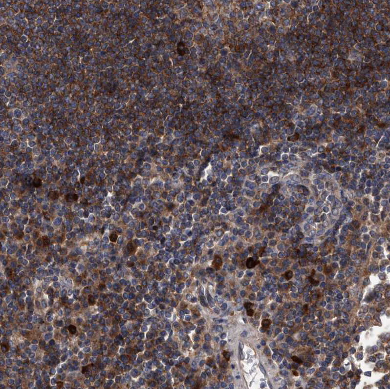 Immunohistochemical staining of human lymph node shows very strong cytoplasmic positivity in germinal center cells.