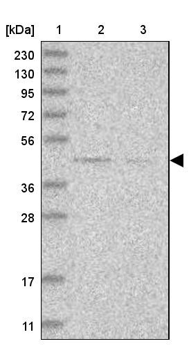 Lane 1: Marker [kDa] 230, 130, 95, 72, 56, 36, 28, 17, 11<br/>Lane 2: Human cell line RT-4<br/>Lane 3: Human cell line U-251MG sp