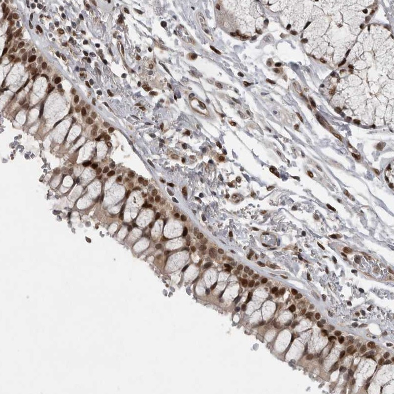 Immunohistochemical staining of human bronchus shows strong nuclear positivity in respiratory epithelial cells.