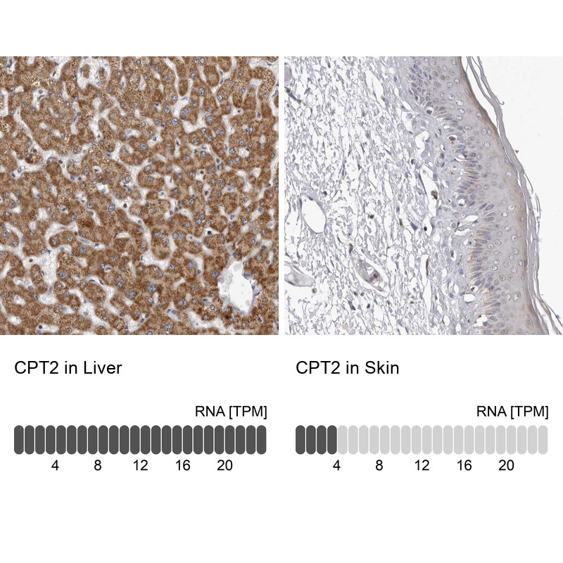 Immunohistochemistry analysis in human liver and skin tissues using HPA028202 antibody. Corresponding CPT2 RNA-seq data are presented for the same tissues.