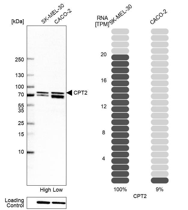 Western blot analysis in human cell line SK-MEL-30 and human cell line CACO-2.