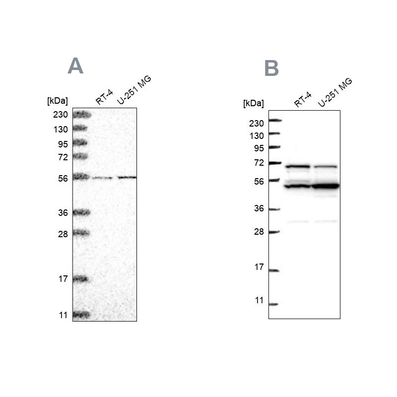 Western blot analysis using Anti-COQ8B antibody HPA028303 (A) shows similar pattern to independent antibody HPA027279 (B).