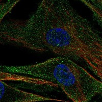 Immunofluorescent staining of human cell line ASC TERT1 shows localization to plasma membrane.