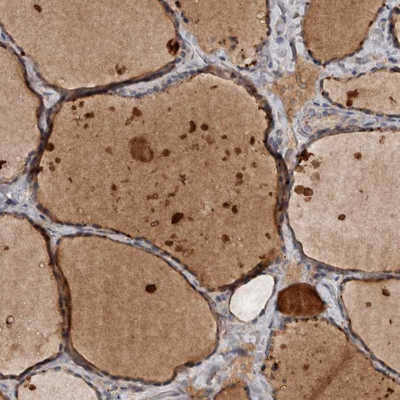 Immunohistochemical staining of human thyroid gland shows strong cytoplasmic positivity in glandular cells.