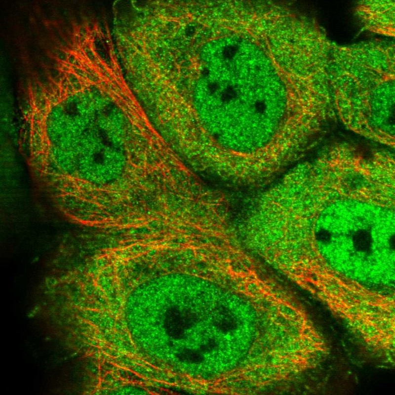 Immunofluorescent staining of human cell line A-431 shows localization to nucleoplasm, plasma membrane & cytosol.