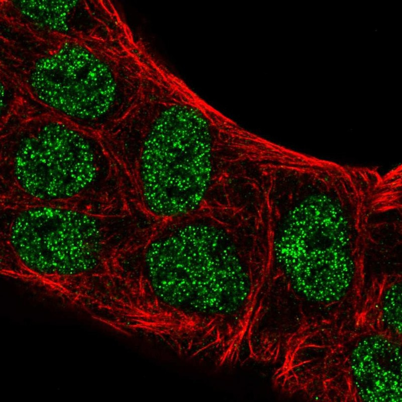 Immunofluorescent staining of human cell line RT4 shows localization to nucleoplasm.
