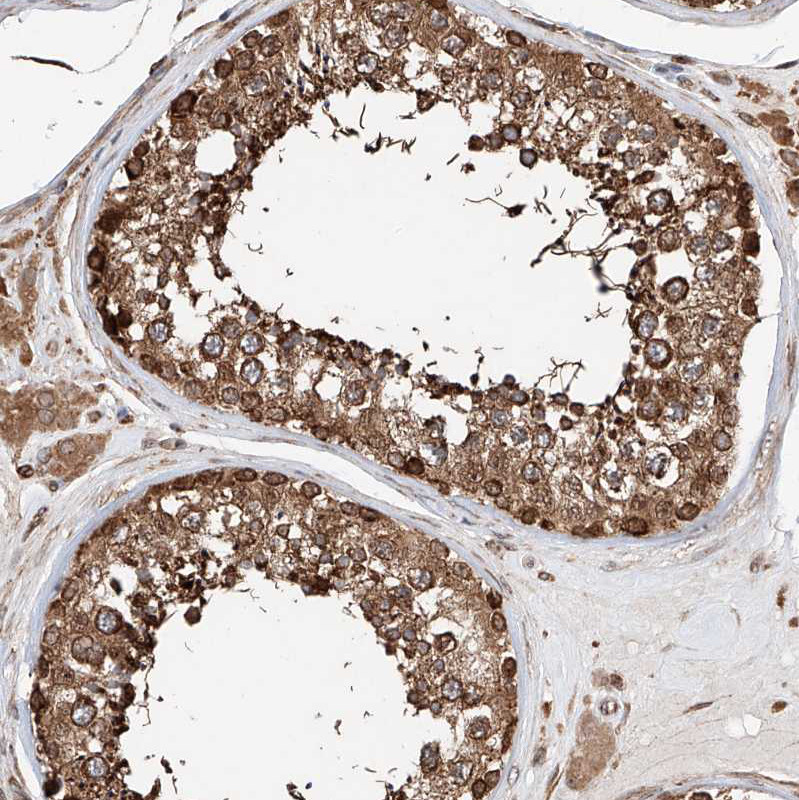 Immunohistochemical staining of human testis shows strong cytoplasmic positivity in cells in seminiferous ducts.