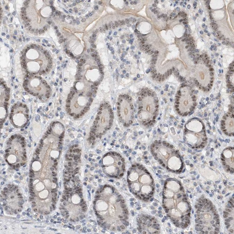 Immunohistochemical staining of human duodenum shows cytoplasmic and nucleoli positivity in glandular cells.