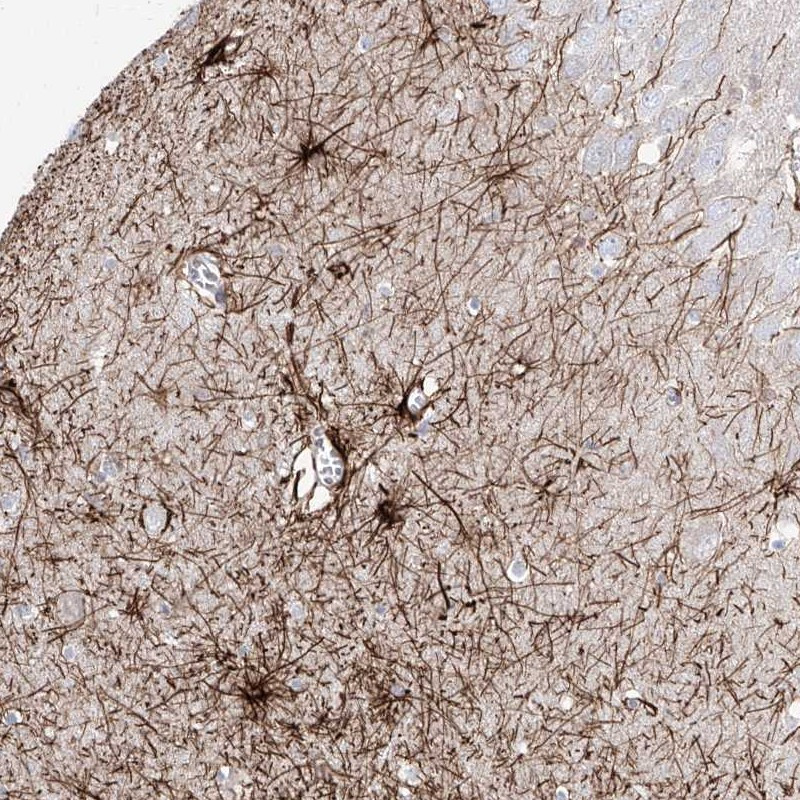 Immunohistochemical staining of human hippocampus shows strong cytoplasmic positivity in astrocytes.