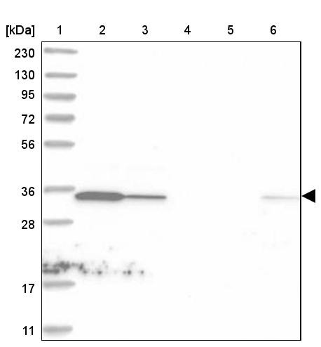 Lane 1: Marker [kDa] 230, 130, 95, 72, 56, 36, 28, 17, 11<br/>Lane 2: Human cell line RT-4<br/>Lane 3: Human cell line U-251MG sp<br/>Lane 4: Human plasma (IgG/HSA depleted)<br/>Lane 5: Human liver tissue<br/>Lane 6: Human tonsil tissue