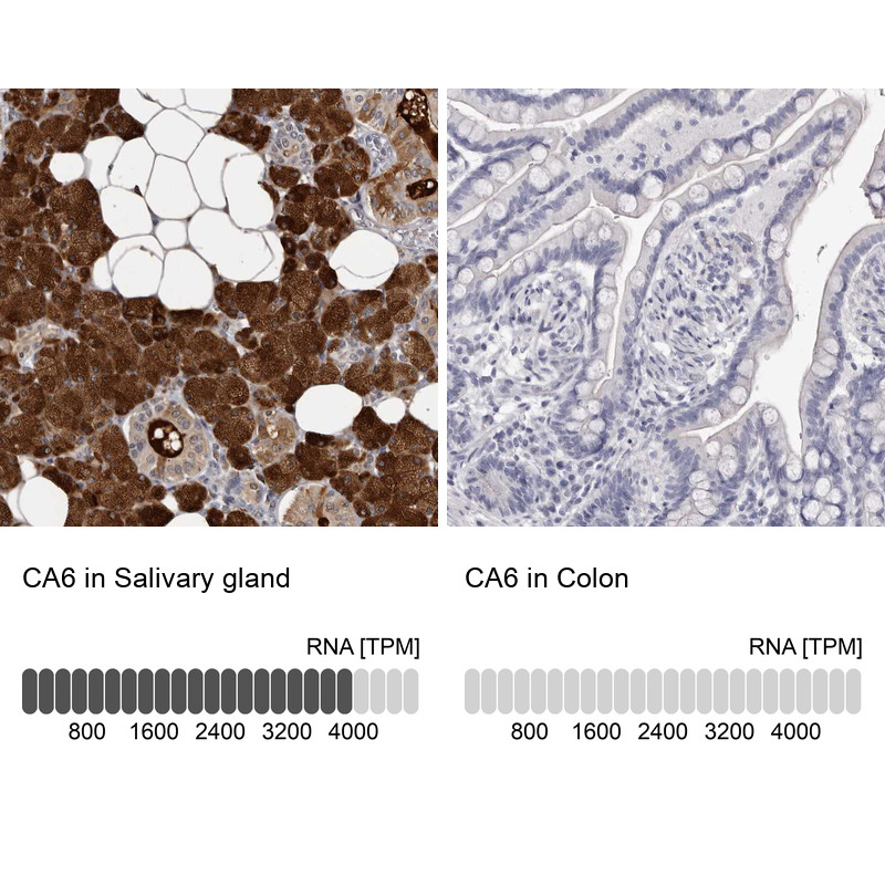 Immunohistochemistry analysis in human salivary gland and colon tissues using Anti-CA6 antibody. Corresponding CA6 RNA-seq data are presented for the same tissues.
