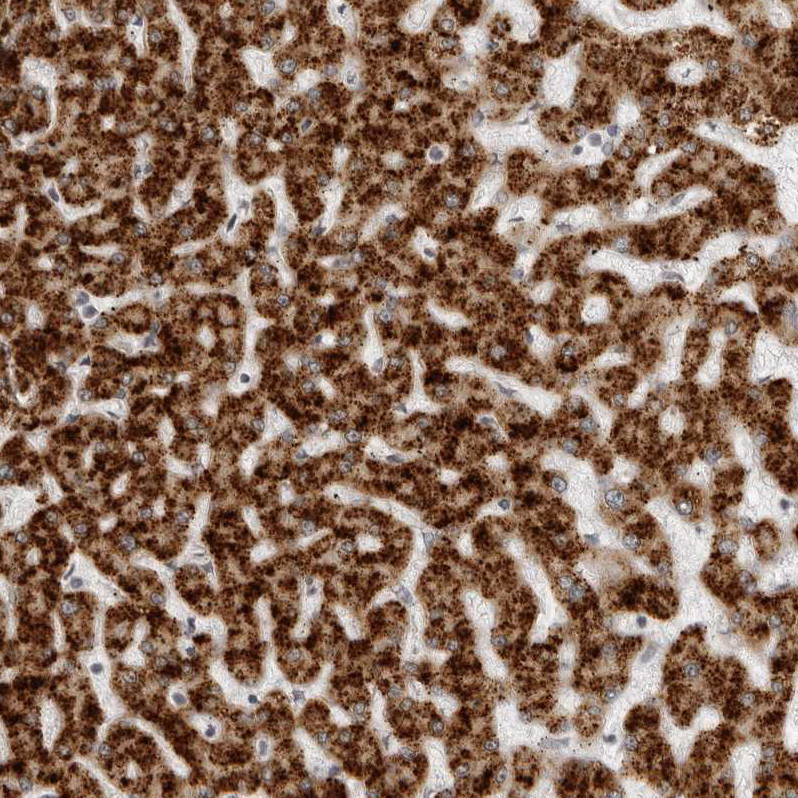 Immunohistochemical staining of human liver shows strong granular cytoplasmic positivity in hepatocytes.