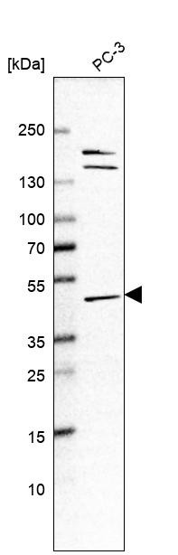 Western blot analysis in human cell line PC-3.